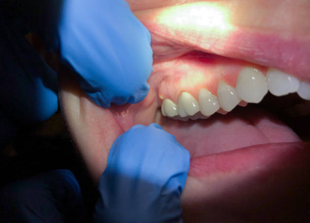 Best Walk-In Dentist Near Me  in Lutcher, LA