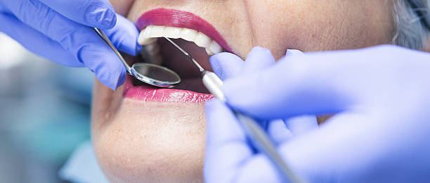 Best Chipped Tooth Repair Near Me  in Lutcher, LA